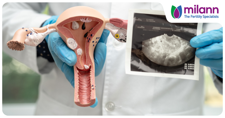 How Does Hysteroscopy Improve Your Chances of Conception?