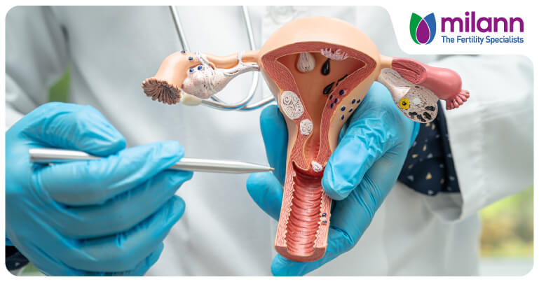 What Is Hysteroscopy Treatment and When Is It Recommended?