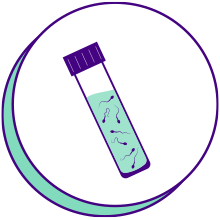 Processing: The collected sample is processed to remove seminal fluid, leaving behind concentrated sperm